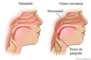 Especialista en Cuerdas Vocales, Laringólogos, Laringología y Trastornos de la Voz