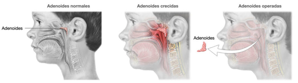 Especialista en Cuerdas Vocales, Laringólogos, Laringología y Trastornos de la Voz