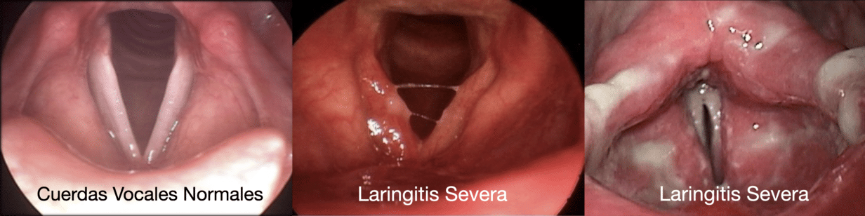 Otorrinolaringólogo especialista en Cuerdas Vocales, Laringología y Trastornos de la Voz.